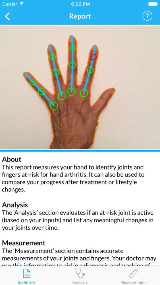 صور LiveWith Arthritis UNMC