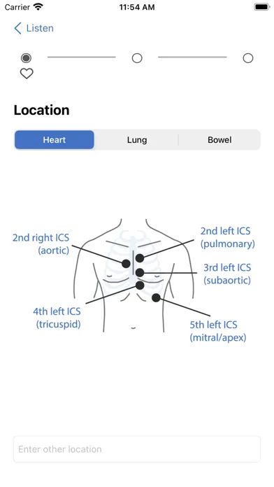 Capturas de tela do eMurmur®