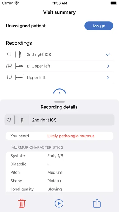 Capturas de tela do eMurmur®