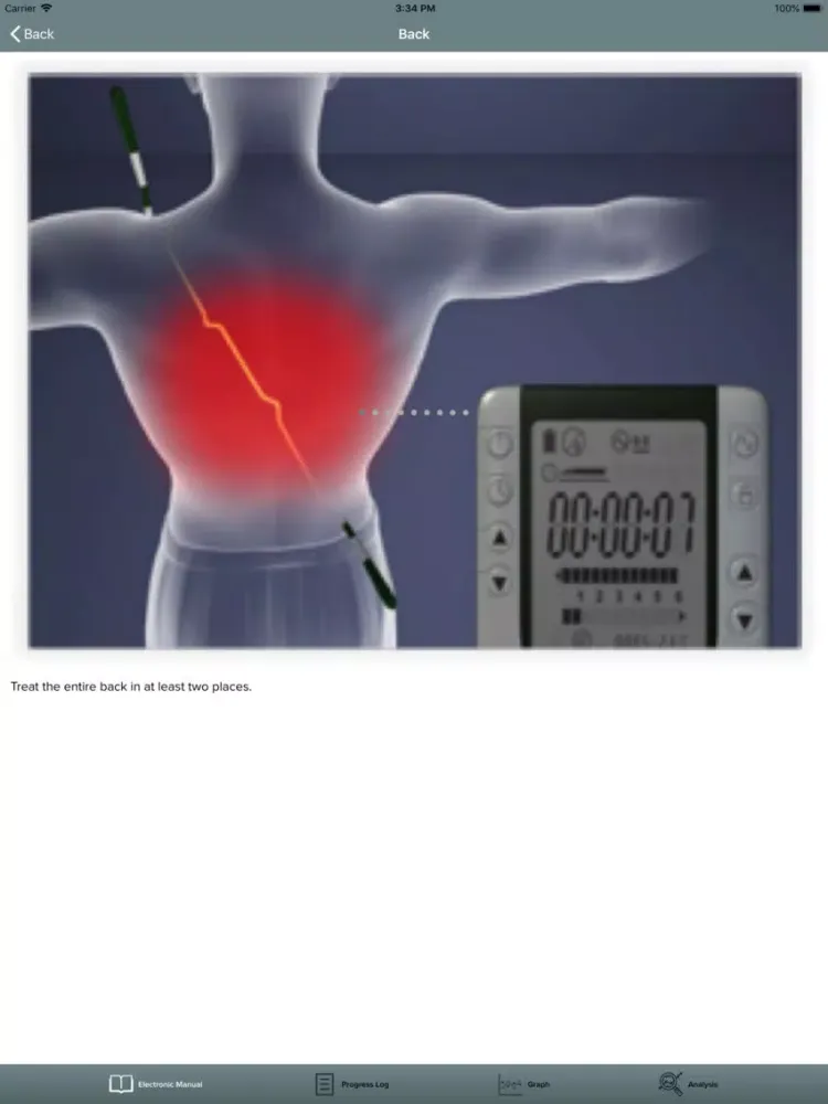 Alpha-Stim iPad  سکرین شاٹس