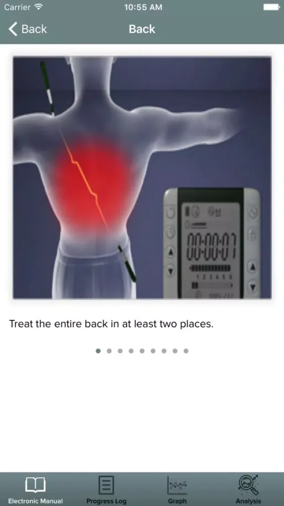 Alpha-Stim سکرین شاٹس