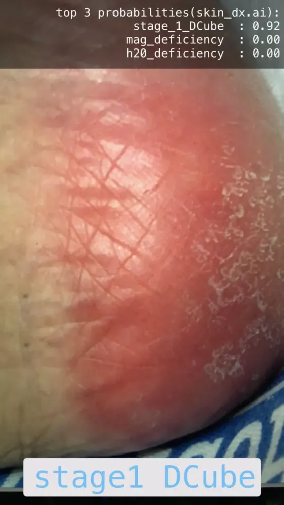 Skin Assess应用截图