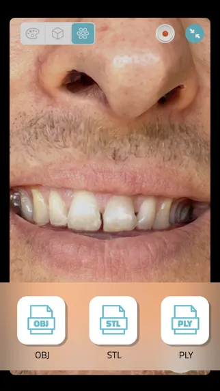 Qlone Dental Pro 3D Scanner Ekran Görüntüleri