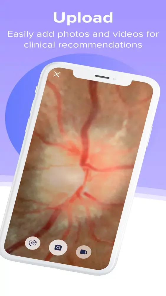 Capturas de tela do Eyeward - Secure Eye Care Chat
