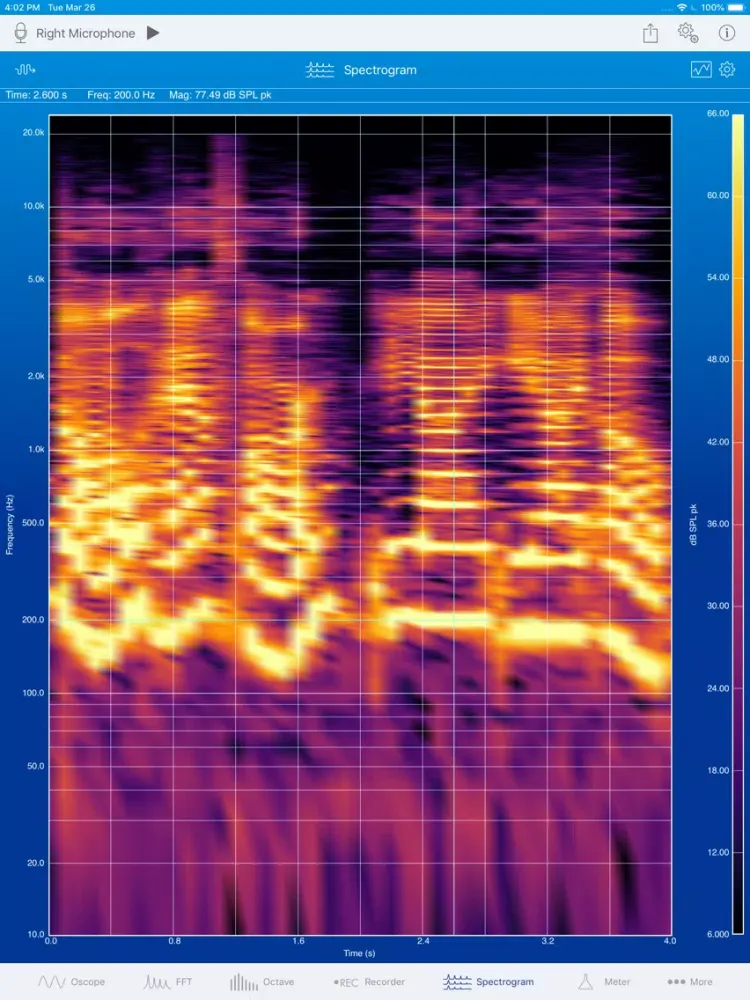 SignalScope Advanced 2018 iPad  Ekran Görüntüleri