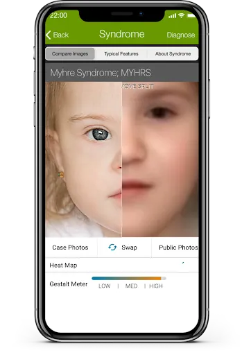 ภาพหน้าจอของ Face2Gene