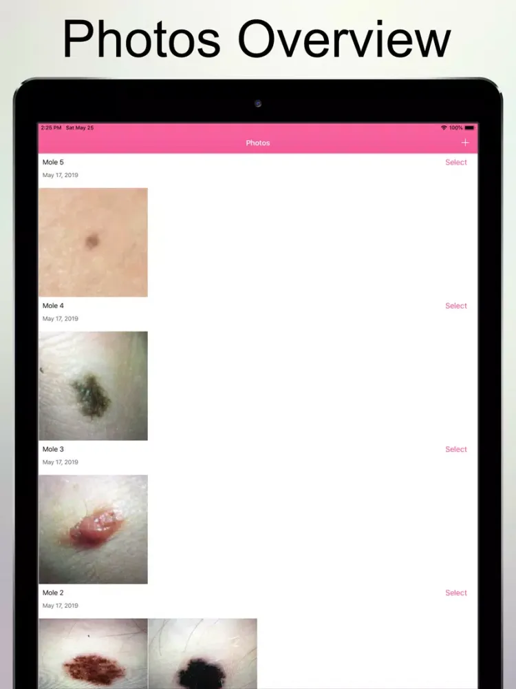 Captures d'écran de Skin Cancer Check iPad 