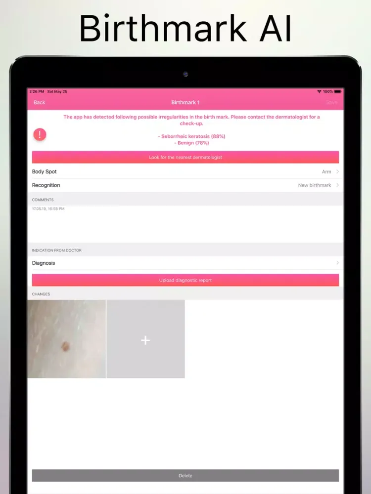 Captures d'écran de Skin Cancer Check iPad 