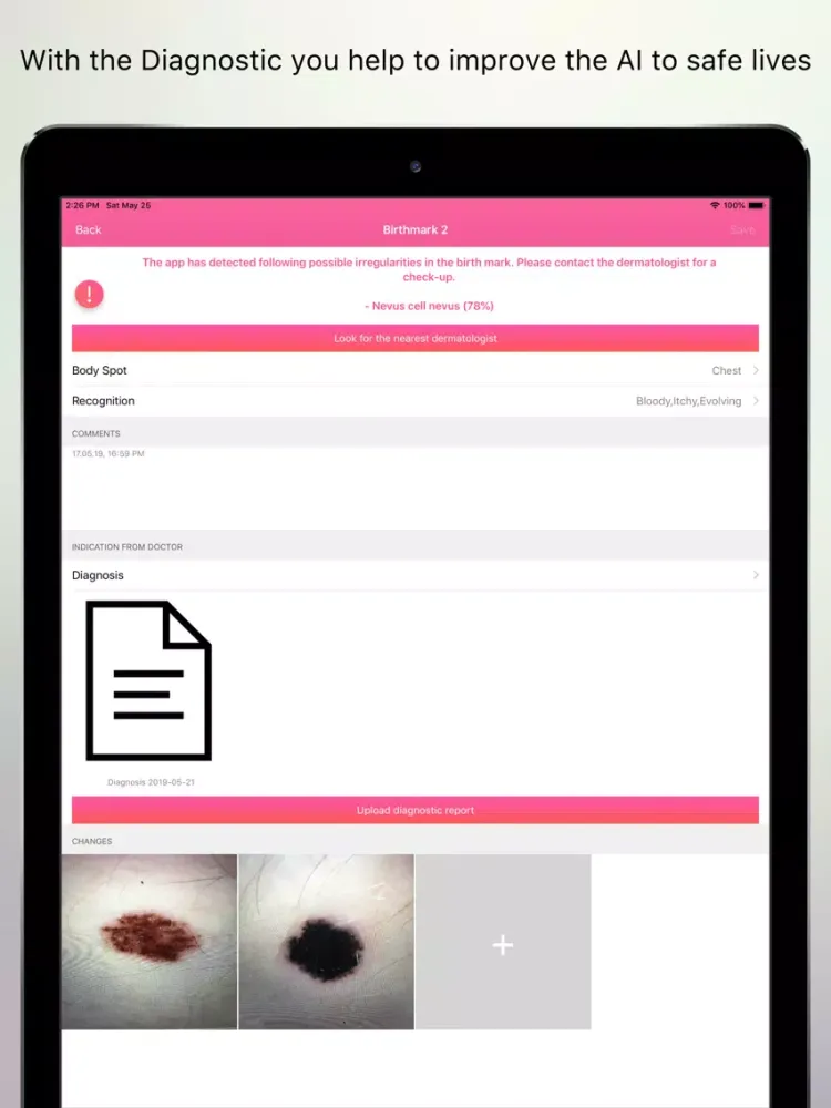 Captures d'écran de Skin Cancer Check iPad 