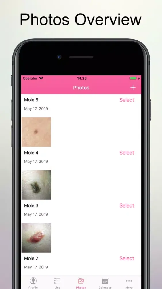 Captures d'écran de Skin Cancer Check