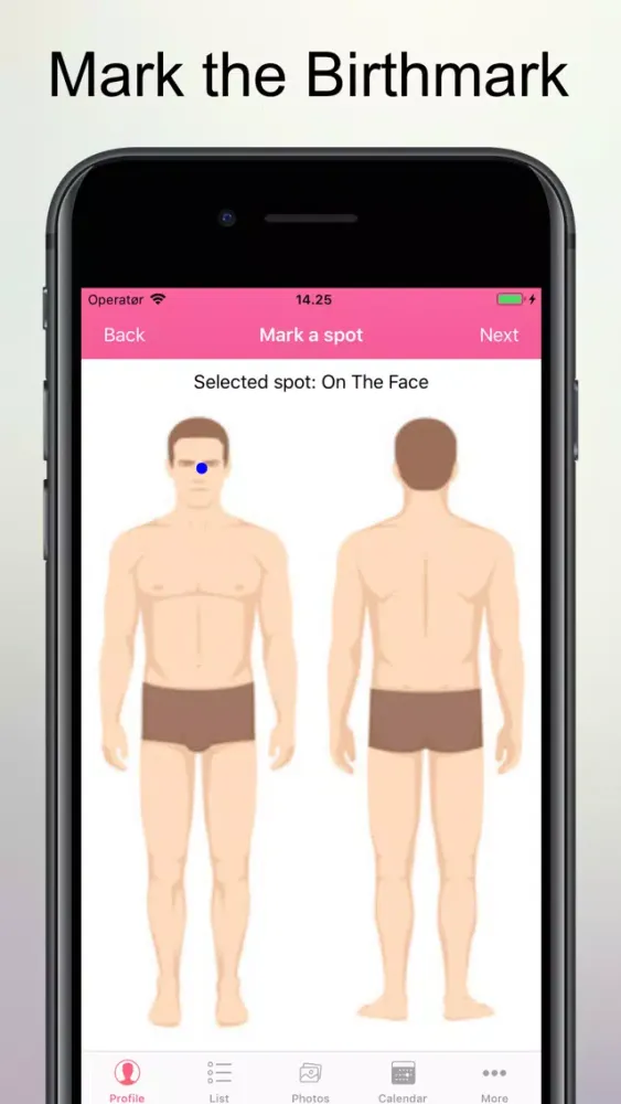 Captures d'écran de Skin Cancer Check