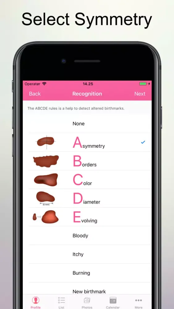 Captures d'écran de Skin Cancer Check