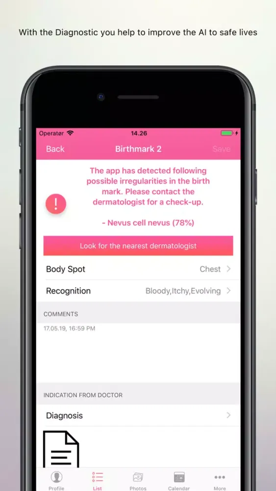 Captures d'écran de Skin Cancer Check