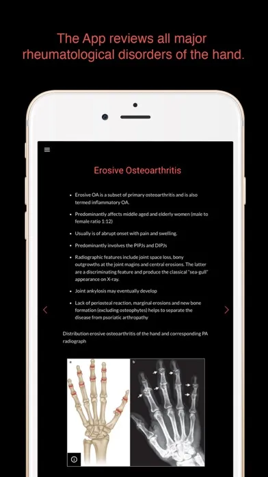 ESIMR: Uncovering The Hand Radiograph Screenshots