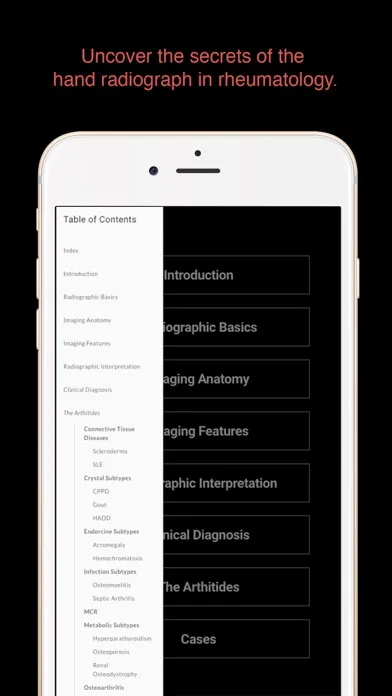 ESIMR: Uncovering The Hand Radiograph Screenshots