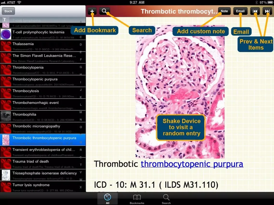 Ảnh chụp màn hình của Blood Disorders Encyclopedia iPad 