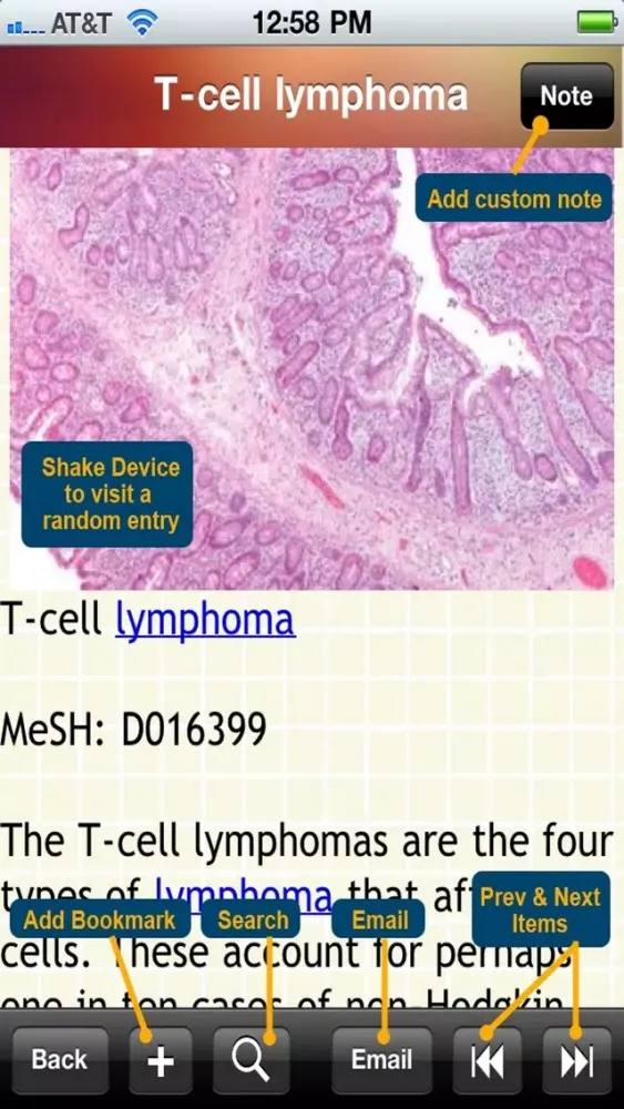 Ảnh chụp màn hình của Blood Disorders Encyclopedia