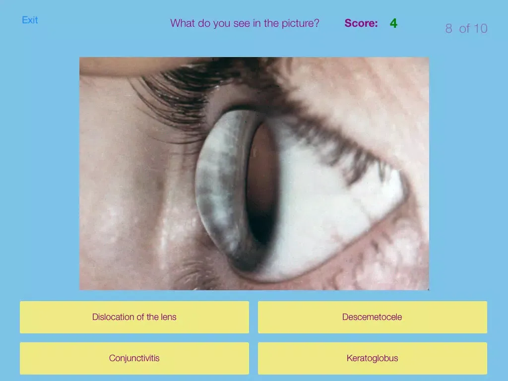 Ảnh chụp màn hình của Ophthalmic Pathology iPad 