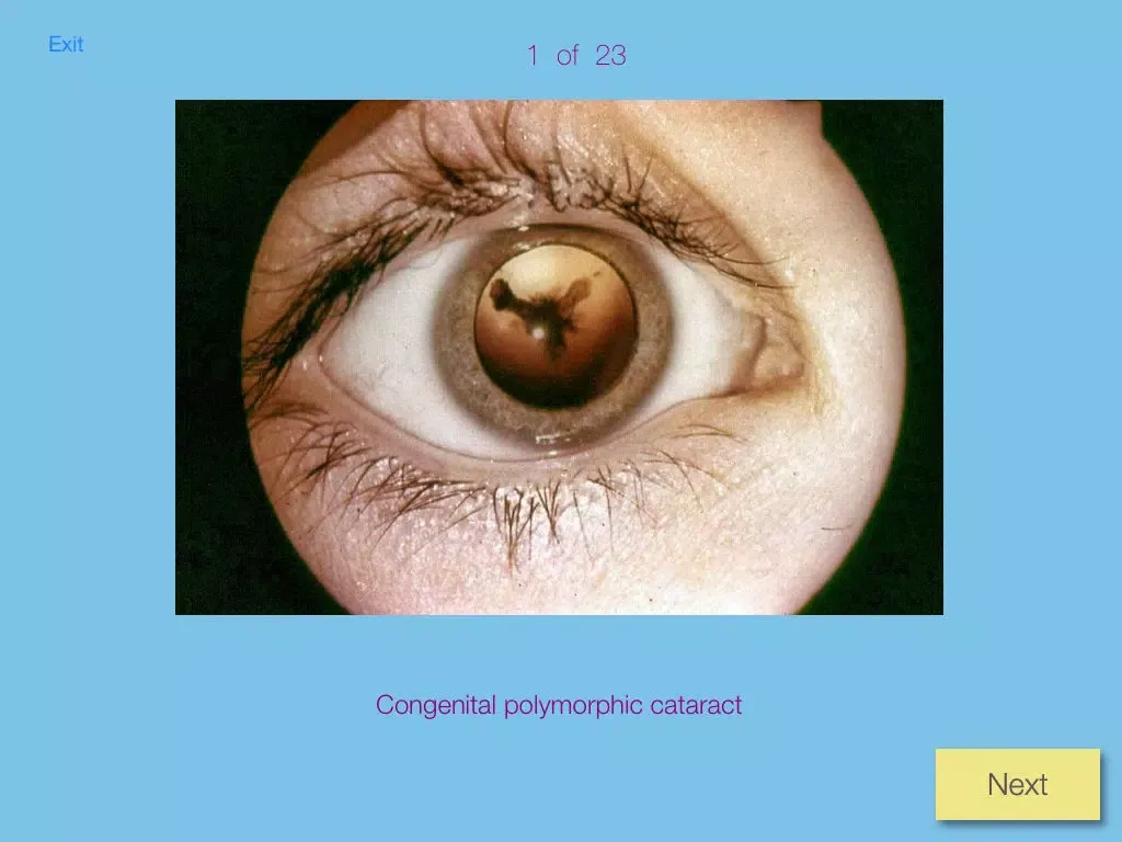 Ảnh chụp màn hình của Ophthalmic Pathology iPad 
