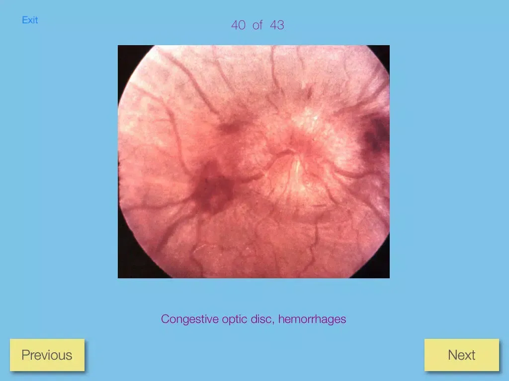 Ảnh chụp màn hình của Ophthalmic Pathology iPad 
