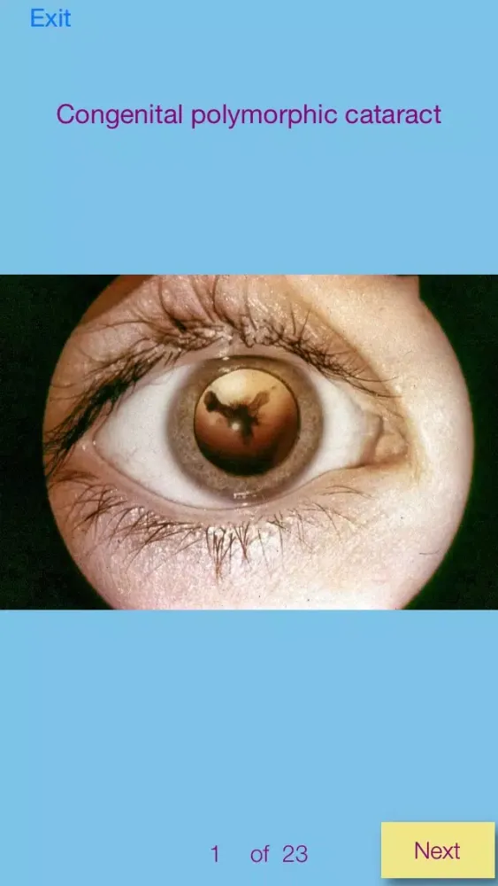 Ảnh chụp màn hình của Ophthalmic Pathology