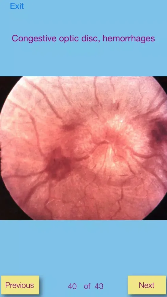 Ảnh chụp màn hình của Ophthalmic Pathology