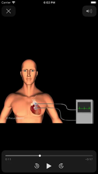 Cardiology Dictionary スクリーンショット