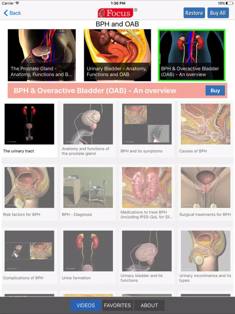 تصاویر Animated Atlas of BPH and OAB iPad 