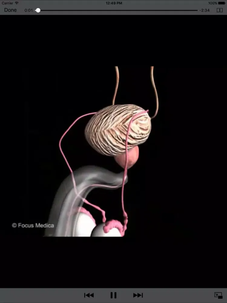 تصاویر Animated Atlas of BPH and OAB iPad 