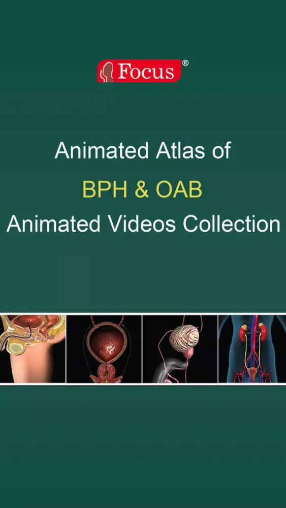 تصاویر Animated Atlas of BPH and OAB