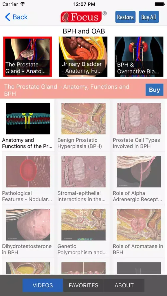 تصاویر Animated Atlas of BPH and OAB