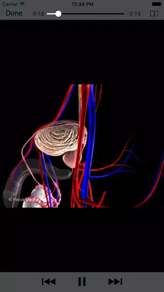 تصاویر Animated Atlas of BPH and OAB