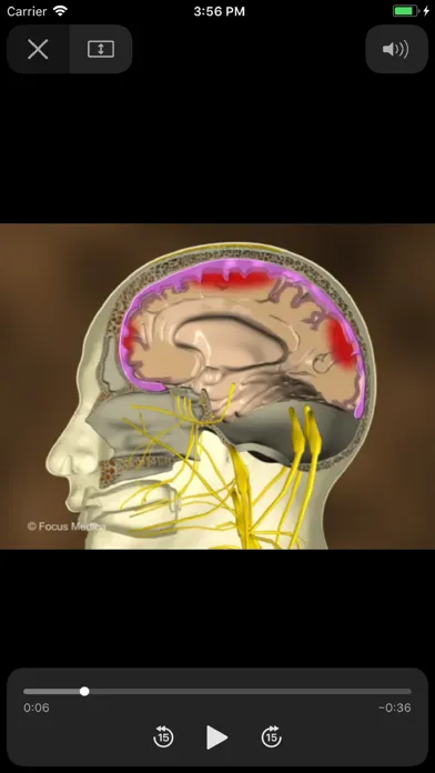 تصاویر NEUROANATOMY - Digital Anatomy