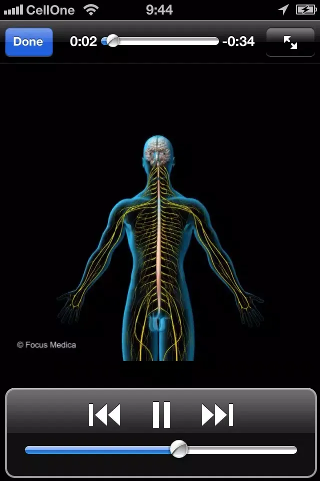 Tangkapan skrin Migraine FAQ