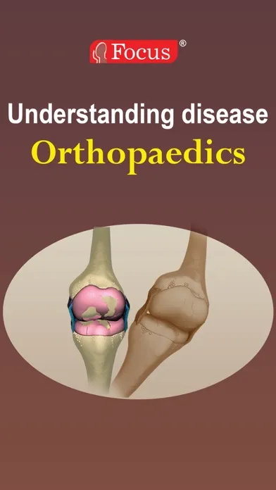 Capturas de pantalla de Orthopaedics - Understanding Disease