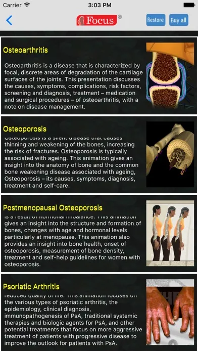 Capturas de pantalla de Orthopaedics - Understanding Disease