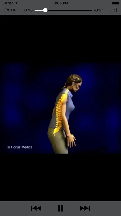 Capturas de pantalla de Orthopaedics - Understanding Disease