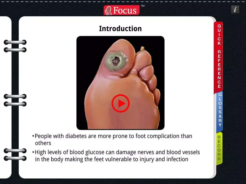 Скриншоты Animated Quick Reference Guide - DiabeticFoot iPad 