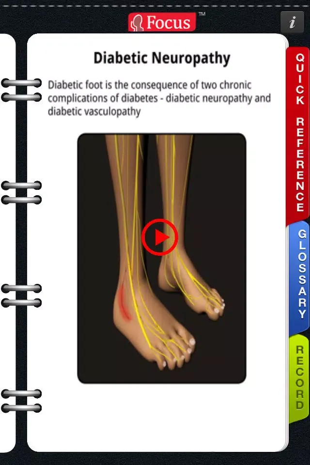 Скриншоты Animated Quick Reference Guide - DiabeticFoot