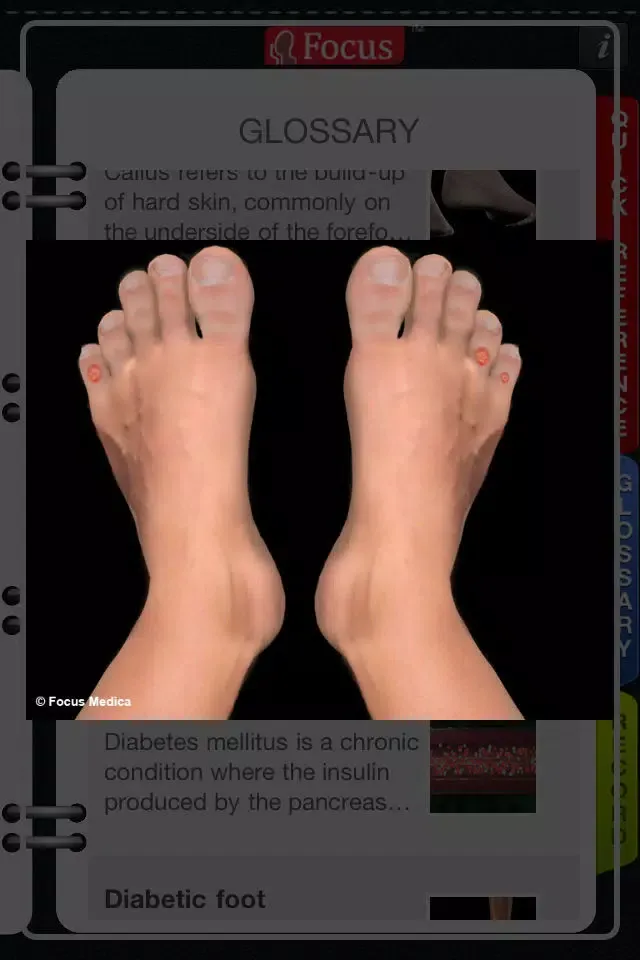 Скриншоты Animated Quick Reference Guide - DiabeticFoot
