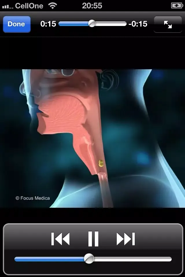 Скриншоты Animated Quick Reference Guide - Dyspepsia