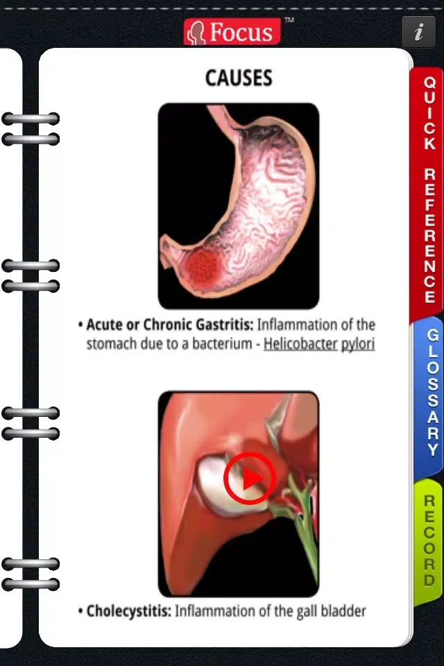 Скриншоты Animated Quick Reference Guide - Dyspepsia