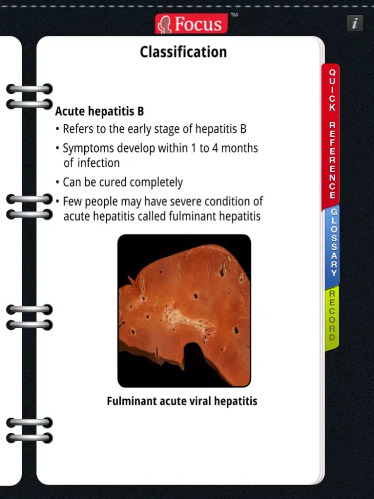 Animated Quick Reference Guide - HepatitisB iPad  Ekran Görüntüleri