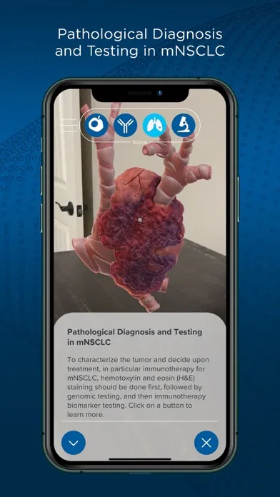 ImmerseRx mNSCLC Immunotherapy 스크린샷
