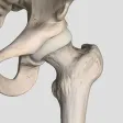 Hip Score