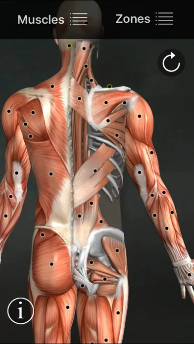صور Muscle Trigger Points
