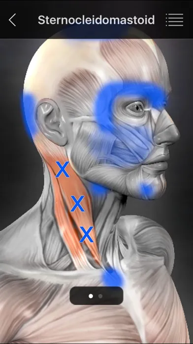 صور Muscle Trigger Points