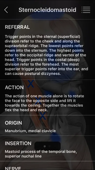 صور Muscle Trigger Points