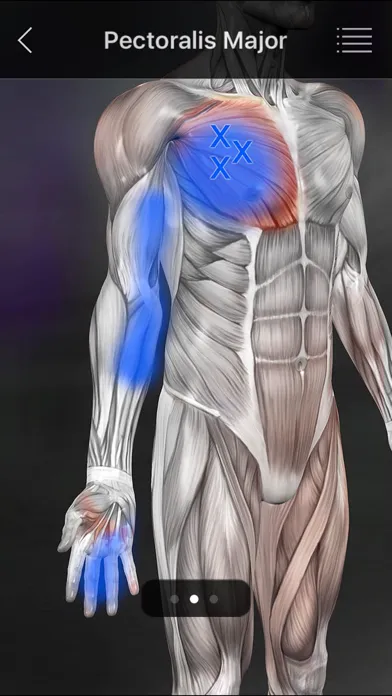 صور Muscle Trigger Points
