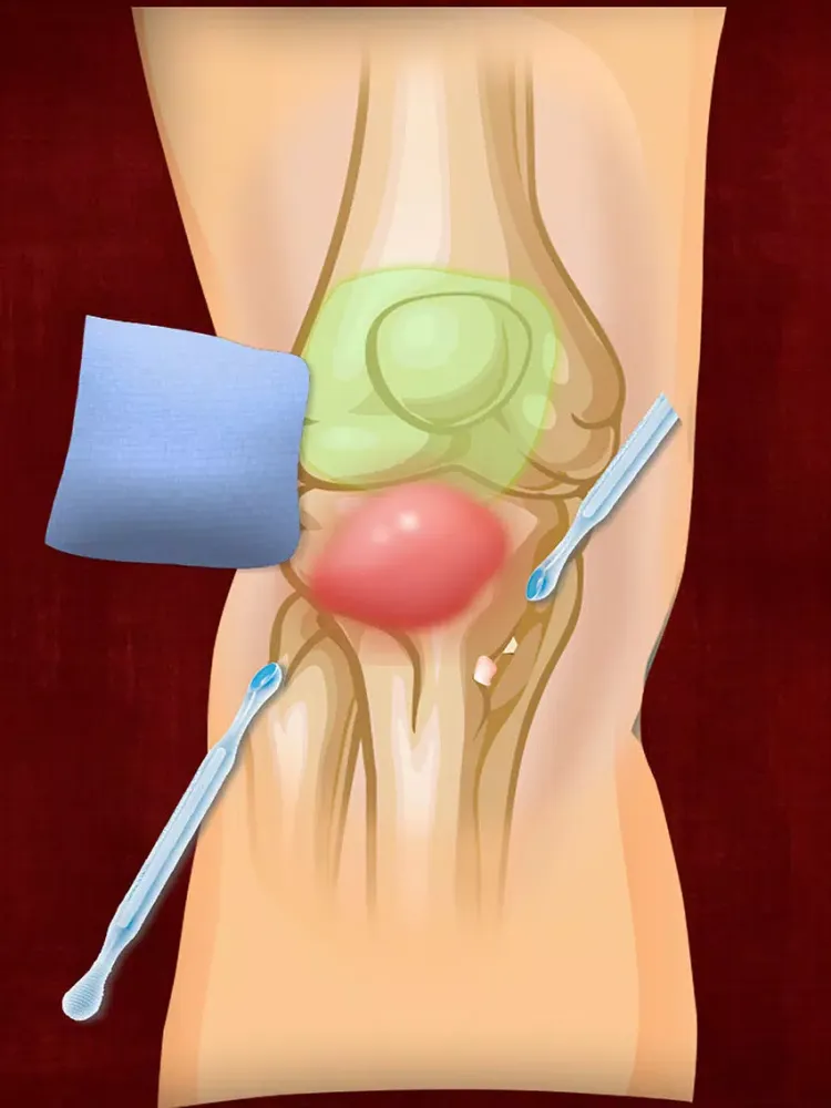 Mega Surgery Doctor Simulation iPad 应用截图